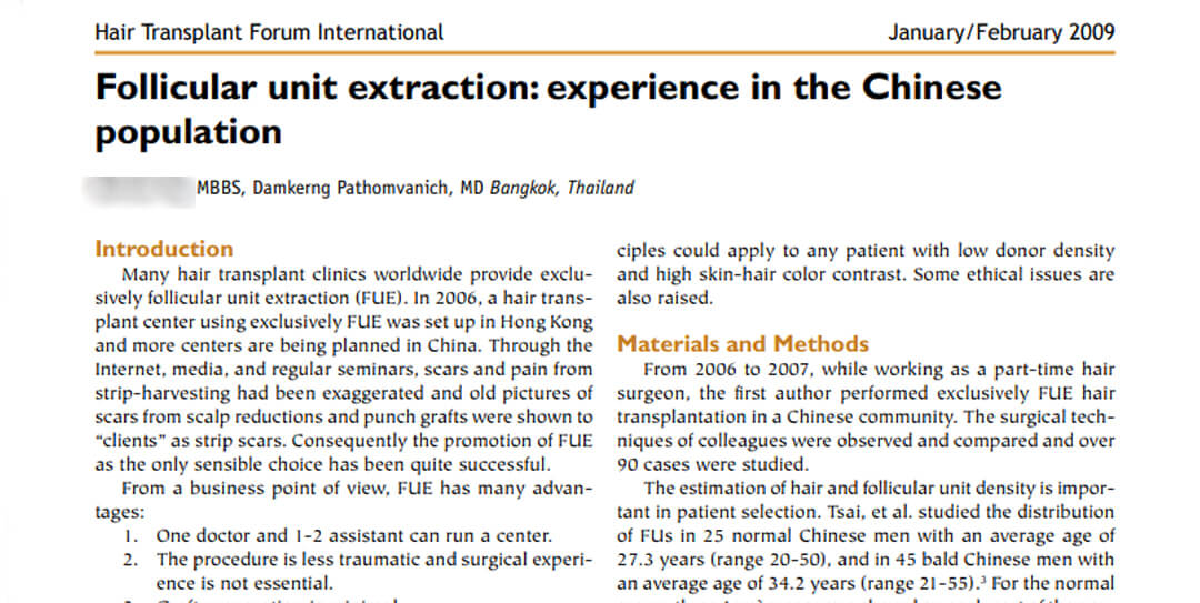 Follicular Unit Extraction: Experience in the Chinese Population