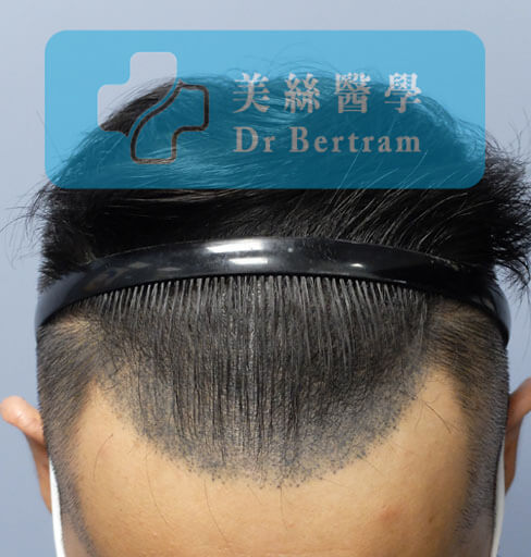 失敗SMP示例