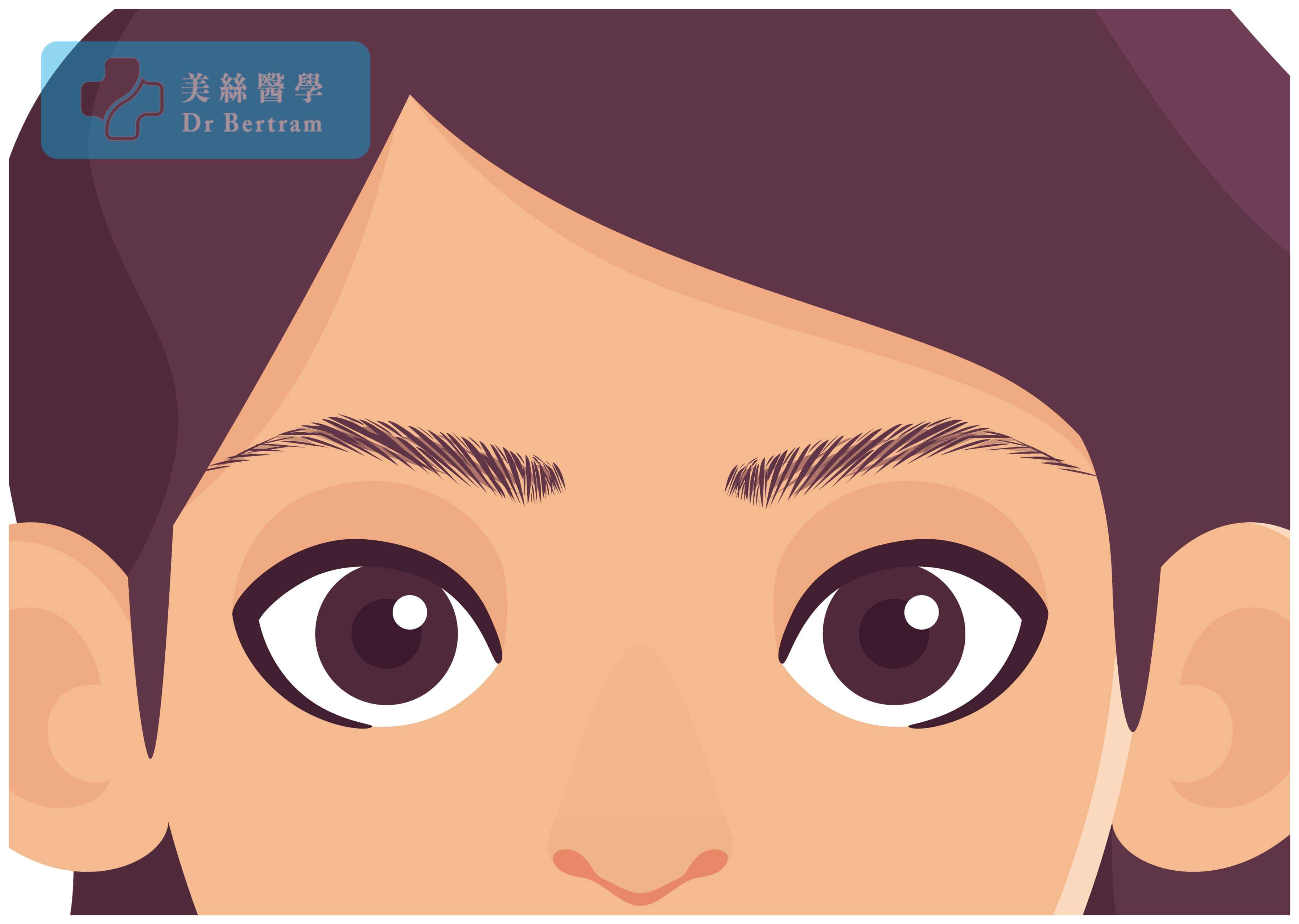 術後效果