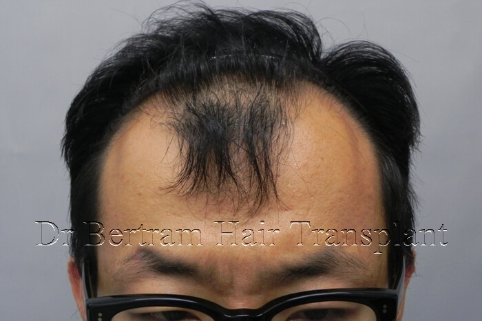 臨床個案:30歲男性