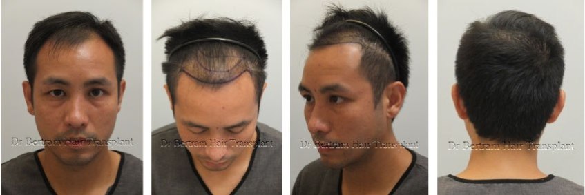 臨床個案：32歲男性