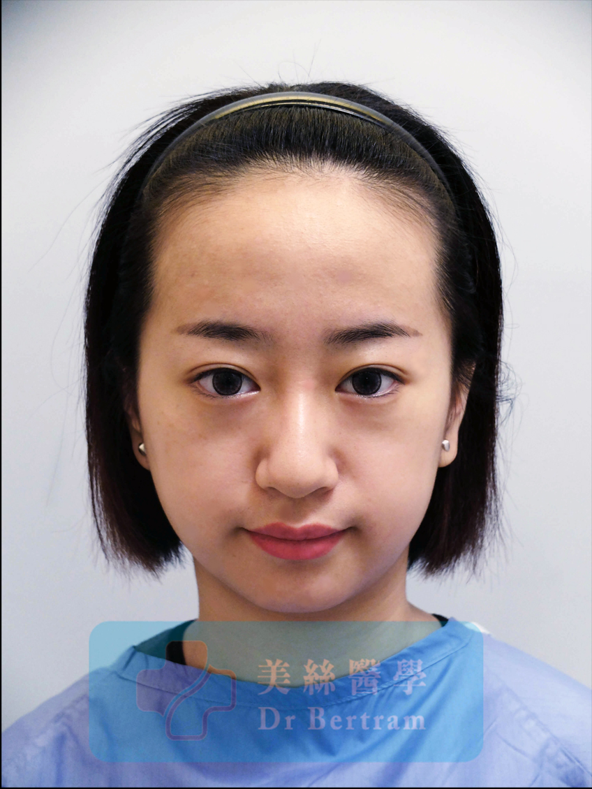 Before