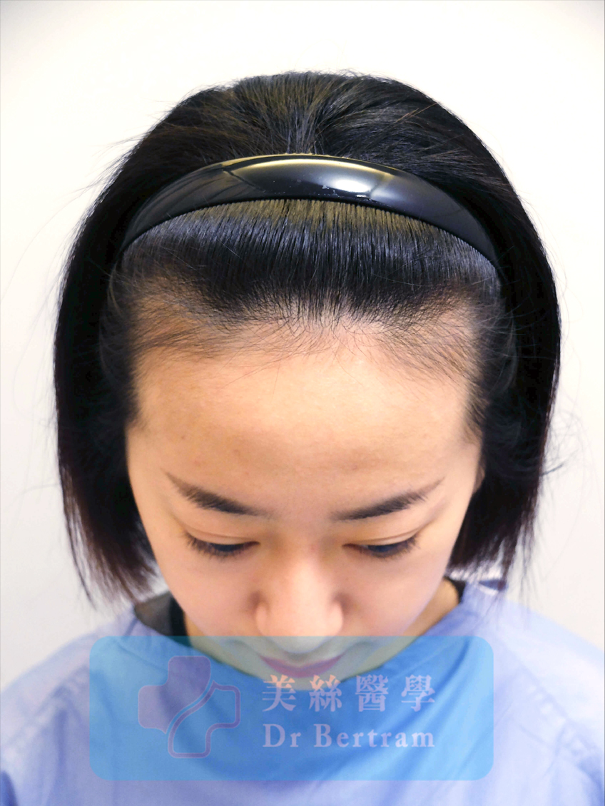 Before