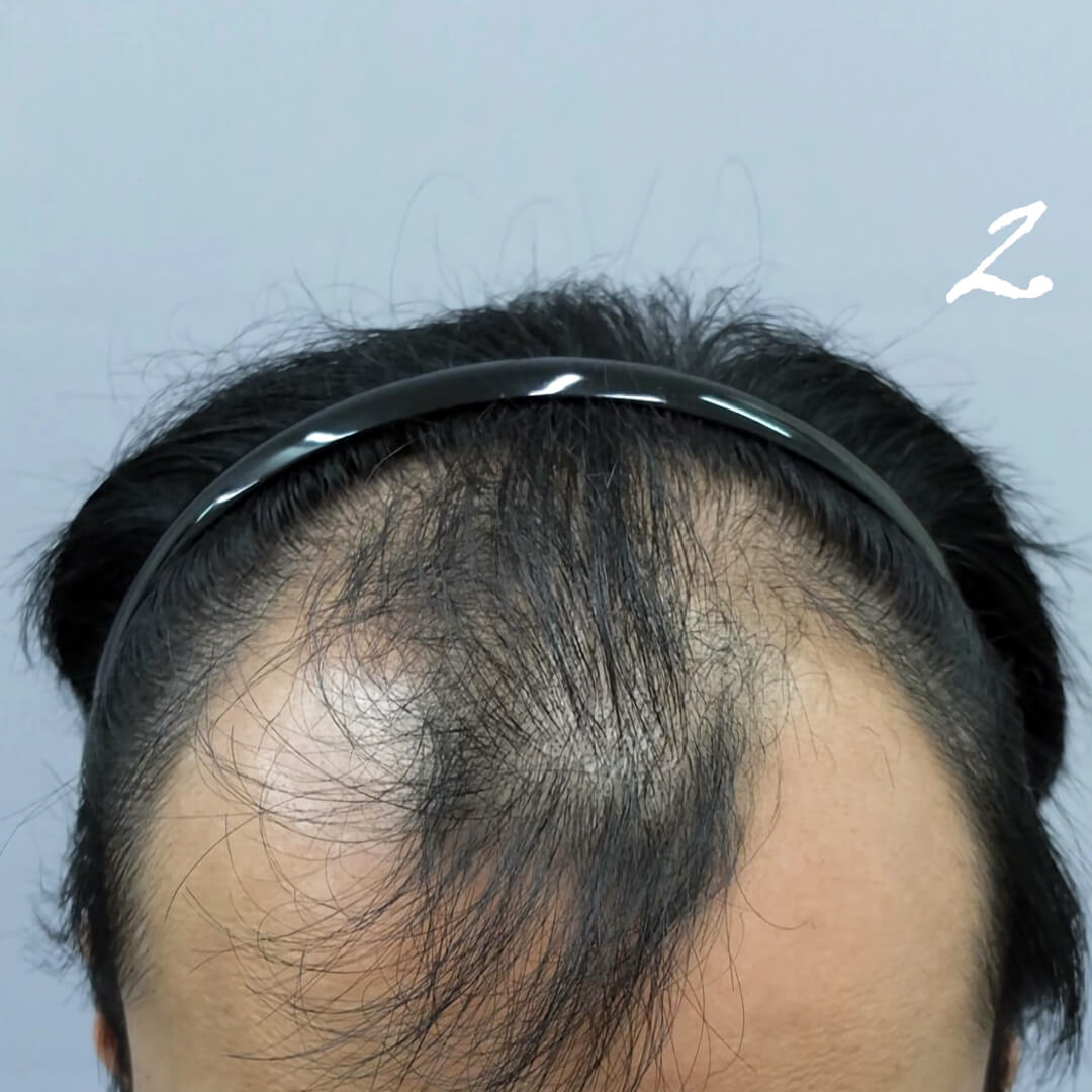正面傾斜角度